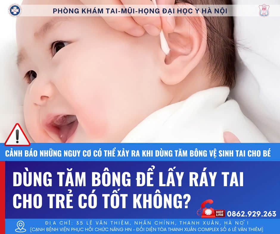 CẢNH BÁO NHỮNG NGUY CƠ CÓ THỂ XẢY RA KHI DÙNG TĂM BÔNG VỆ SINH TAI CHO BÉ