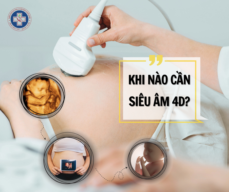KHI NÀO CẦN SIÊU ÂM 4D?