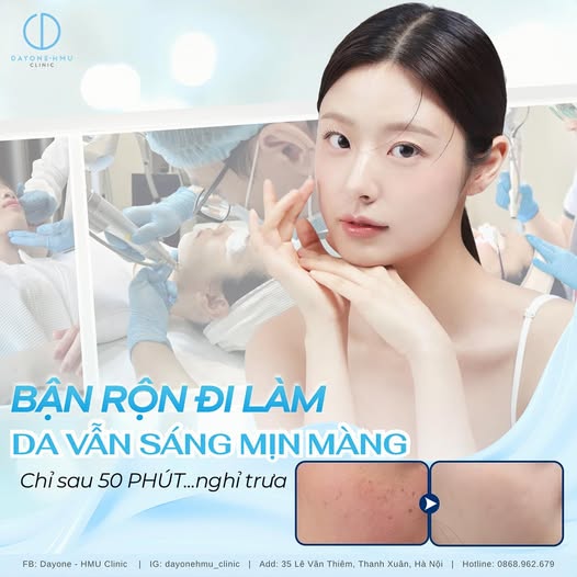 LASER TONING – BÍ QUYẾT SỞ HỮU LÀN DA SÁNG MỊN!
