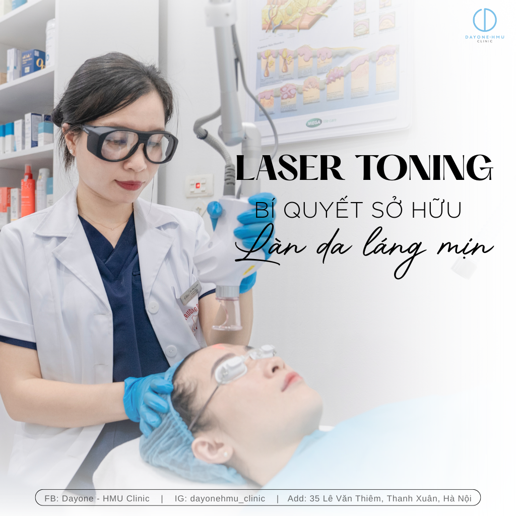 LASER TONING – Bí quyết cho làn da sáng mịn, đều màu
