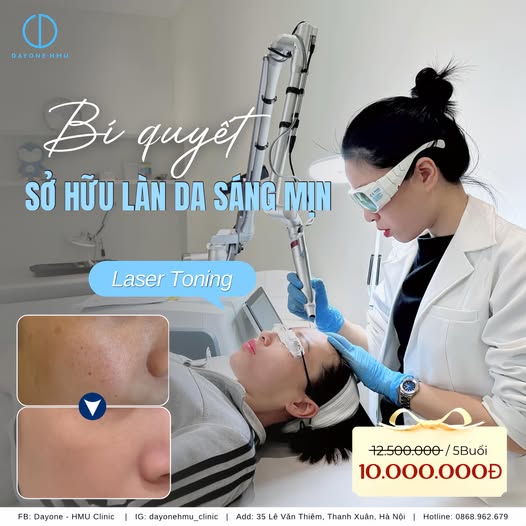 LASER TONING – GIẢI PHÁP LÀM SÁNG VÀ ĐỀU MÀU DA MỘT CÁCH AN TOÀN