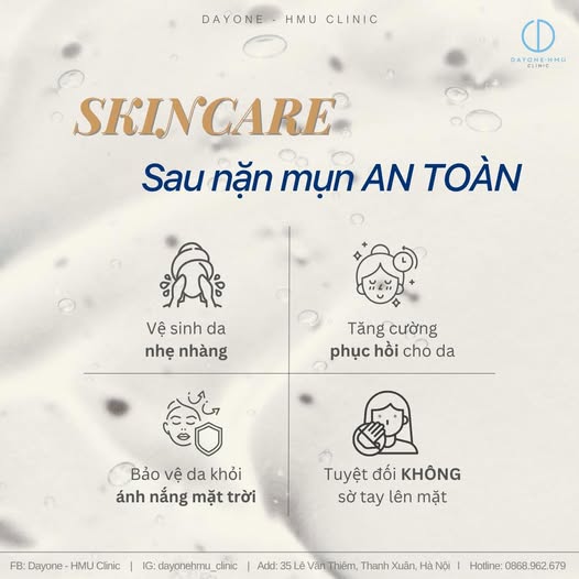 4 TUÝP SKINCARE SAU KHI NẶN MỤN – CỨU CÁNH CHO LÀN DA BẠN ĐỪNG BỎ LỠ!