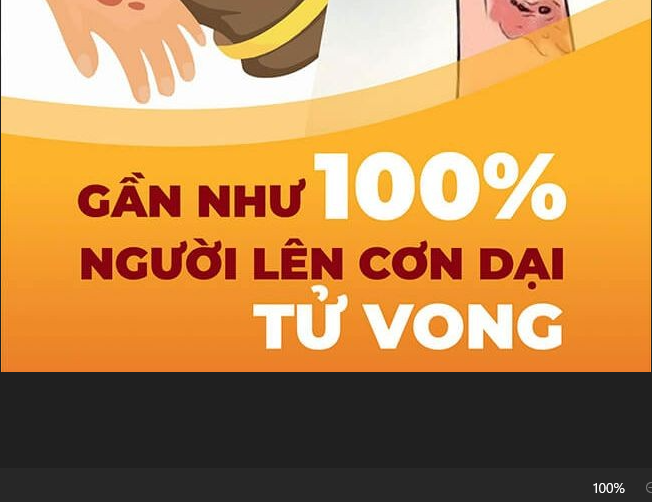 TIÊM DỰ PHÒNG VẮC XIN DẠI VÀ HUYẾT THANH KHÁNG DẠI CÀNG SỚM CÀNG TỐT LÀ BIỆN PHÁP DUY NHẤT CỨU SỐNG NGƯỜI SAU KHI PHƠI NHIỄM VỚI VIRUS DẠI