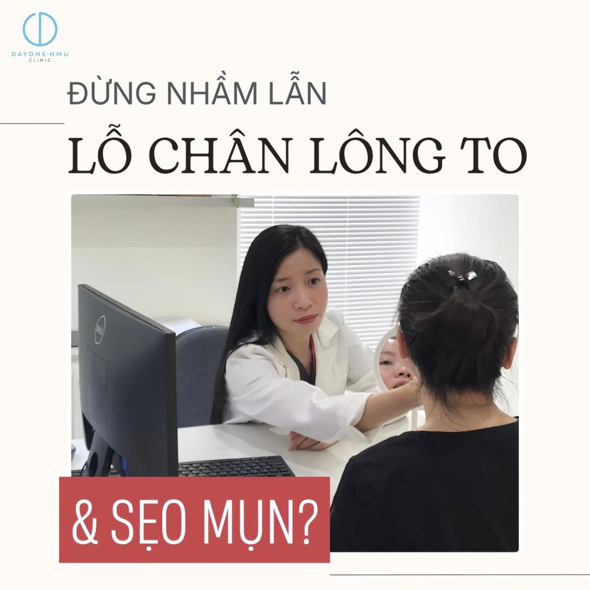 ĐỪNG NHẦM LẪN: LỖ CHÂN LÔNG TO HAY SẸO MỤN?