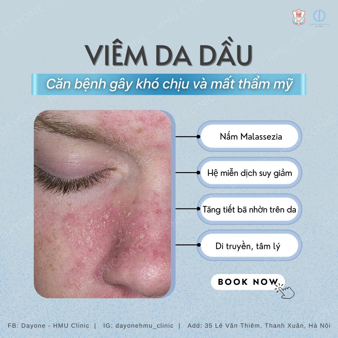 VIÊM DA DẦU VÀ NHỮNG ĐIỀU BẠN CẦN BIẾT