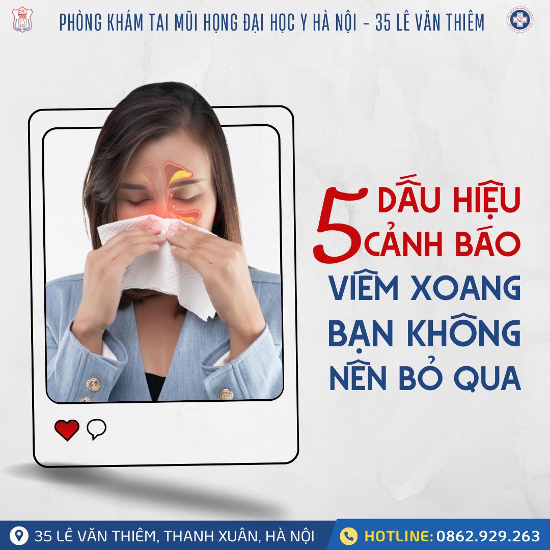 5 DẤU HIỆU CẢNH BÁO VIÊM XOANG – ĐỪNG CHỦ QUAN VỚI SỨC KHỎE HÔ HẤP CỦA BẠN! 5 DẤU HIỆU CẢNH BÁO VIÊM XOANG – ĐỪNG CHỦ QUAN VỚI SỨC KHỎE HÔ HẤP CỦA BẠN!