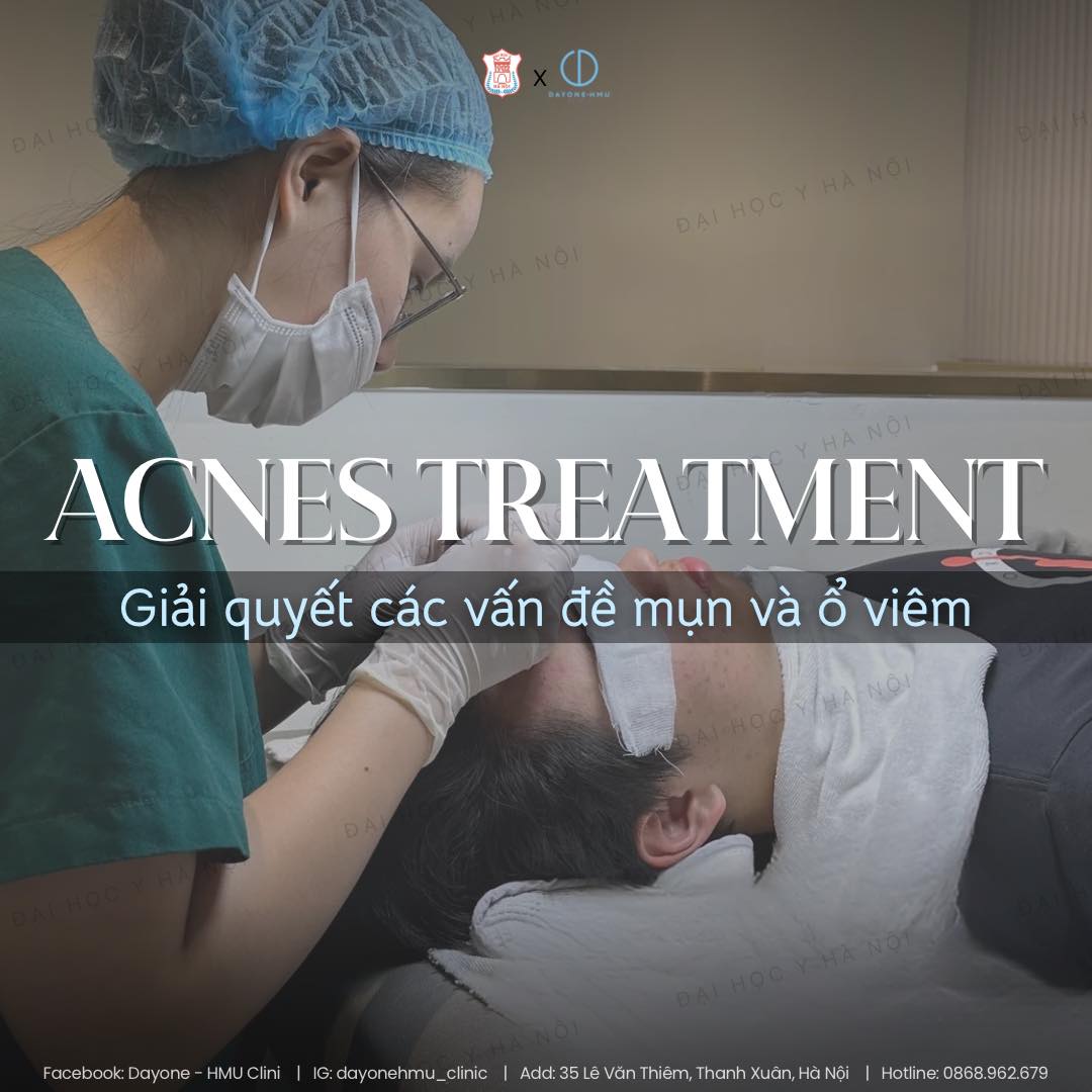 Acnes Treatments - Nặn mụn chuẩn y khoa