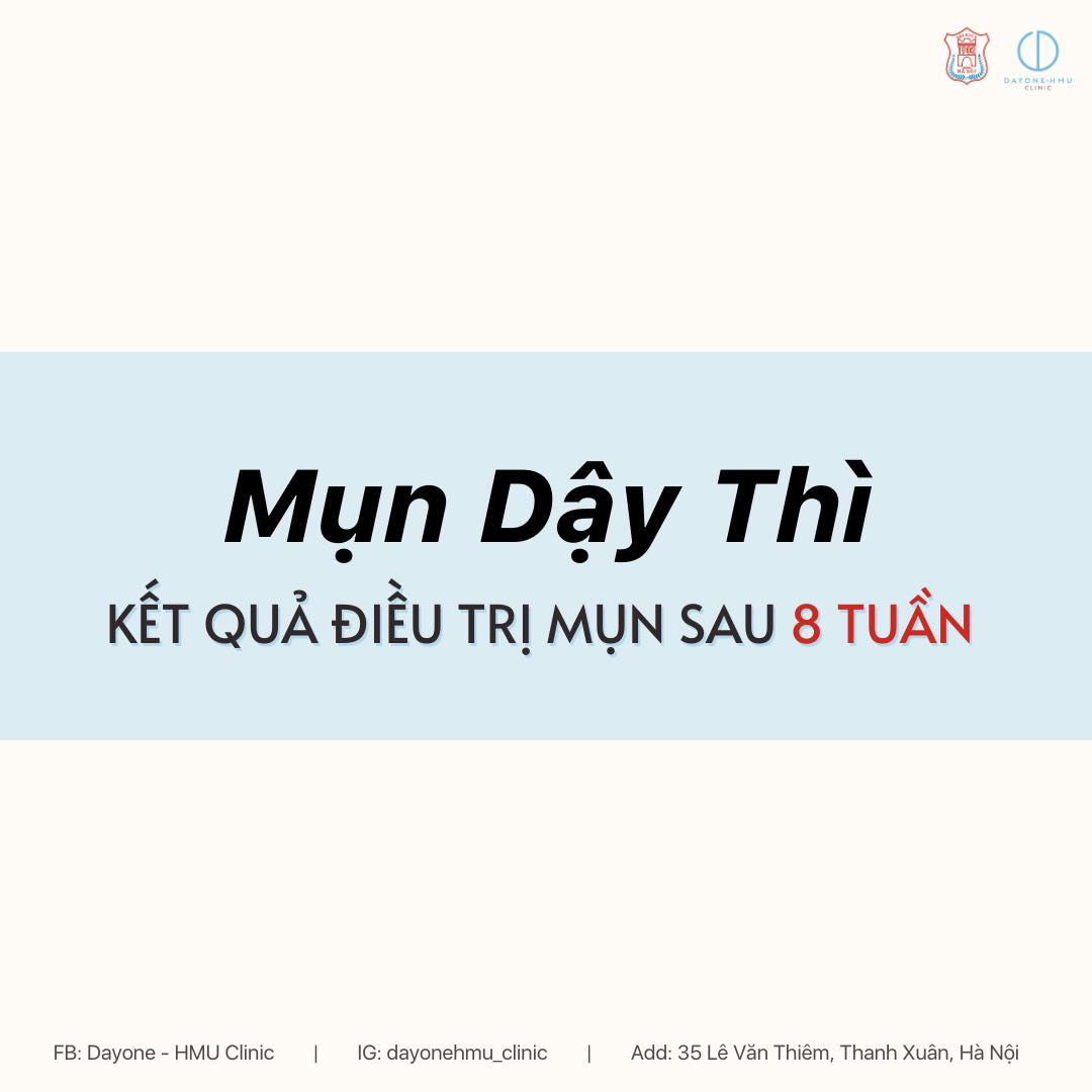 KẾT QUẢ ĐIỀU TRỊ MỤN SAU 8 TUẦN TẠI DAYONE-HMU CLINIC