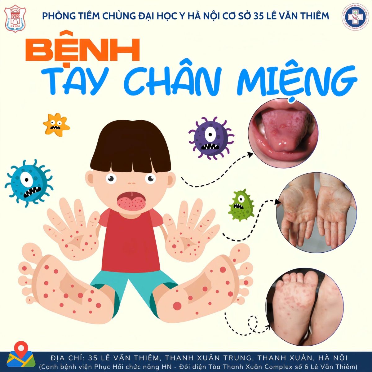 Đẩy mạnh phòng chống bệnh Tay chân miệng