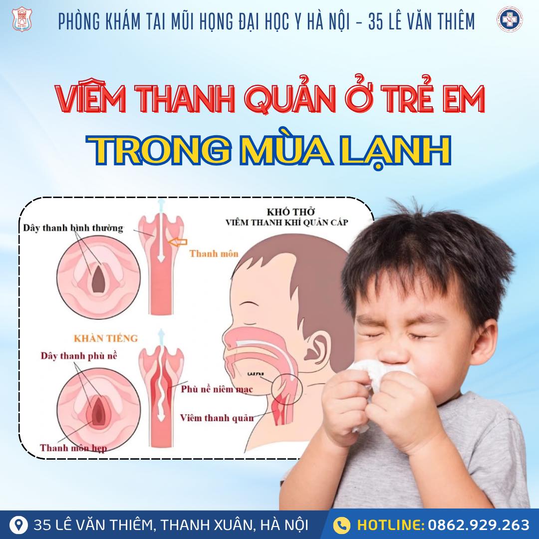 CẢNH BÁO CHA MẸ: VIÊM THANH QUẢN Ở TRẺ – CĂN BỆNH “MÙA LẠNH” KHÔNG NÊN XEM NHẸ