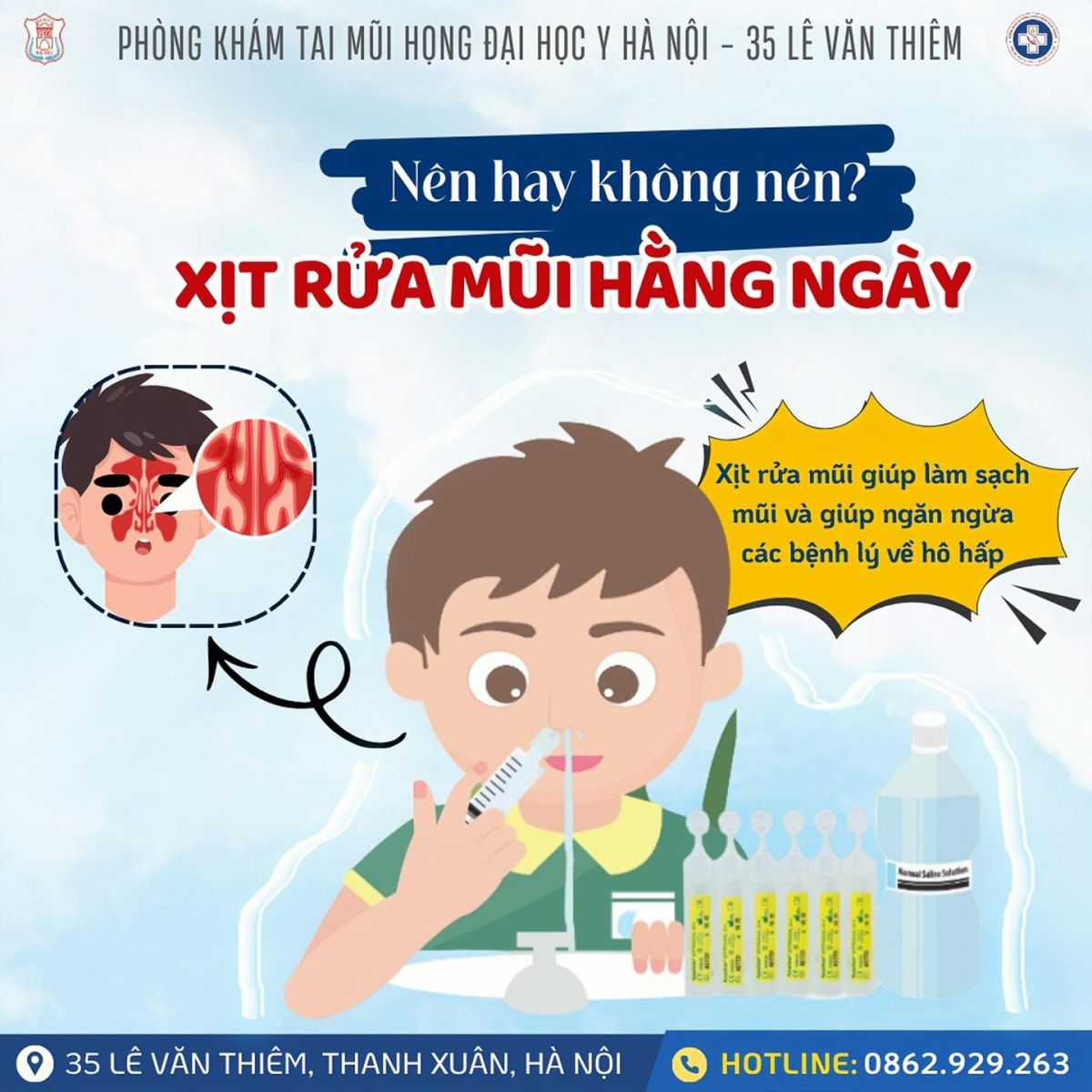 NÊN HAY KHÔNG NÊN XỊT RỬA MŨI HẰNG NGÀY