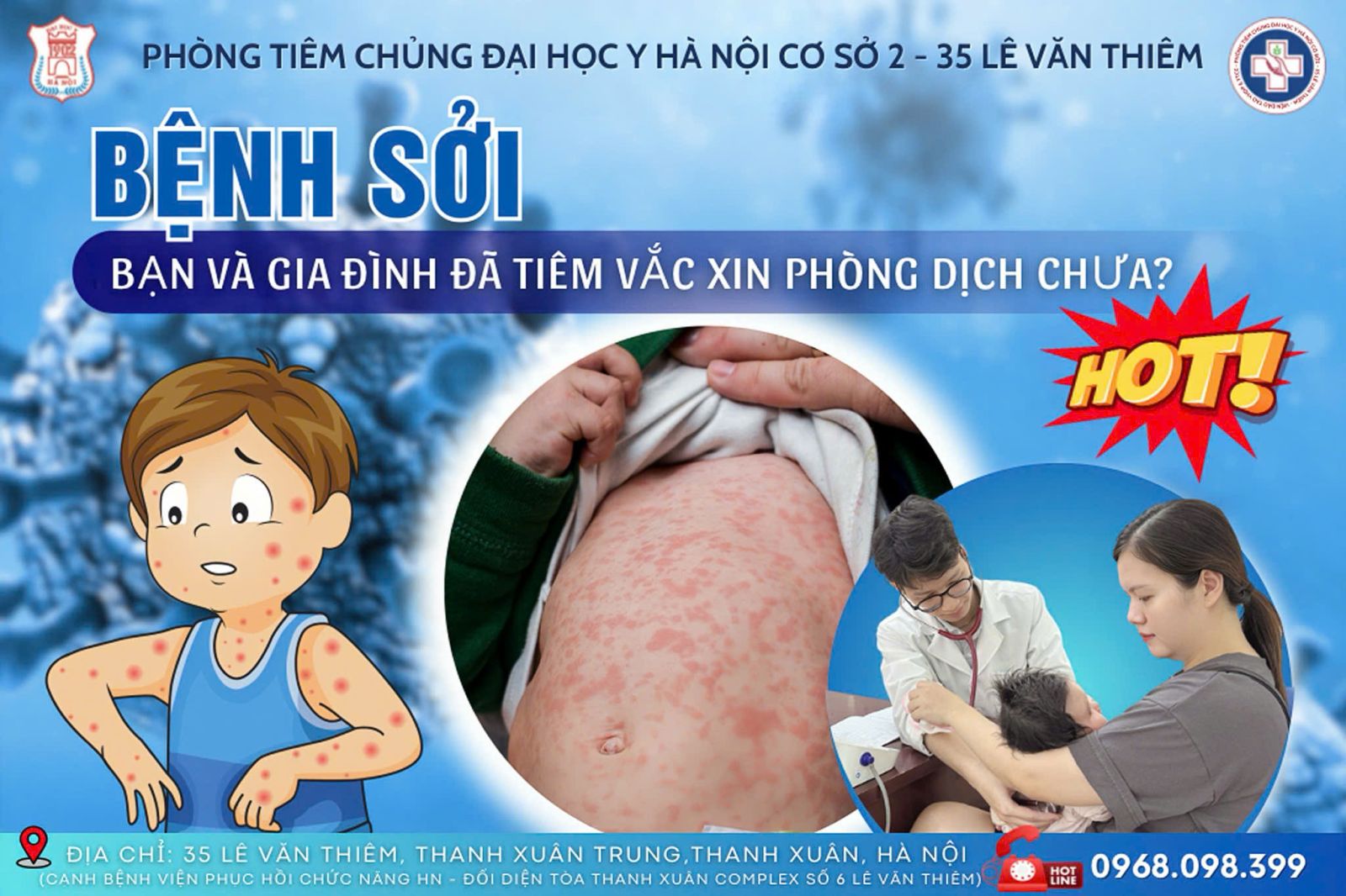 ĐẦY ĐỦ CÁC LOẠI VẮC XIN PHÒNG SỞI - QUAI BỊ - RUBELLA